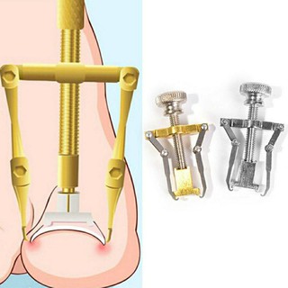 Dụng cụ chữa móng quặp