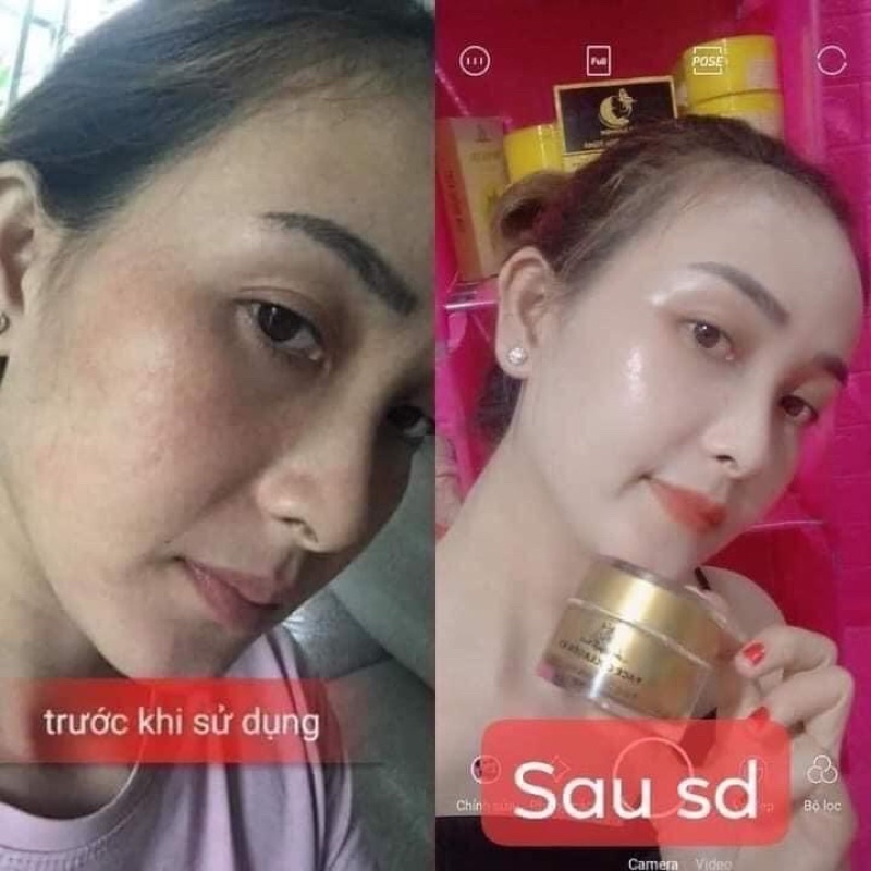 [Chính Hãng]Kem Face Collagen X3 Đông Anh trắng da xoá nám tàn nhang mụn thâm