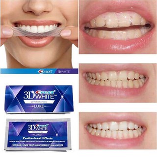 Miếng dán trắng răng Crest 3D Whitestrips (Bill Mỹ)