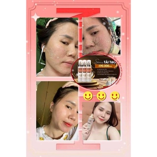 Bộ tái tạo da ko sưng ko đỏ tặng kèm bộ kem sâm sau tái tạo