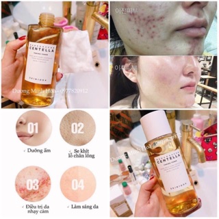 Toner Rau Má Skin1004