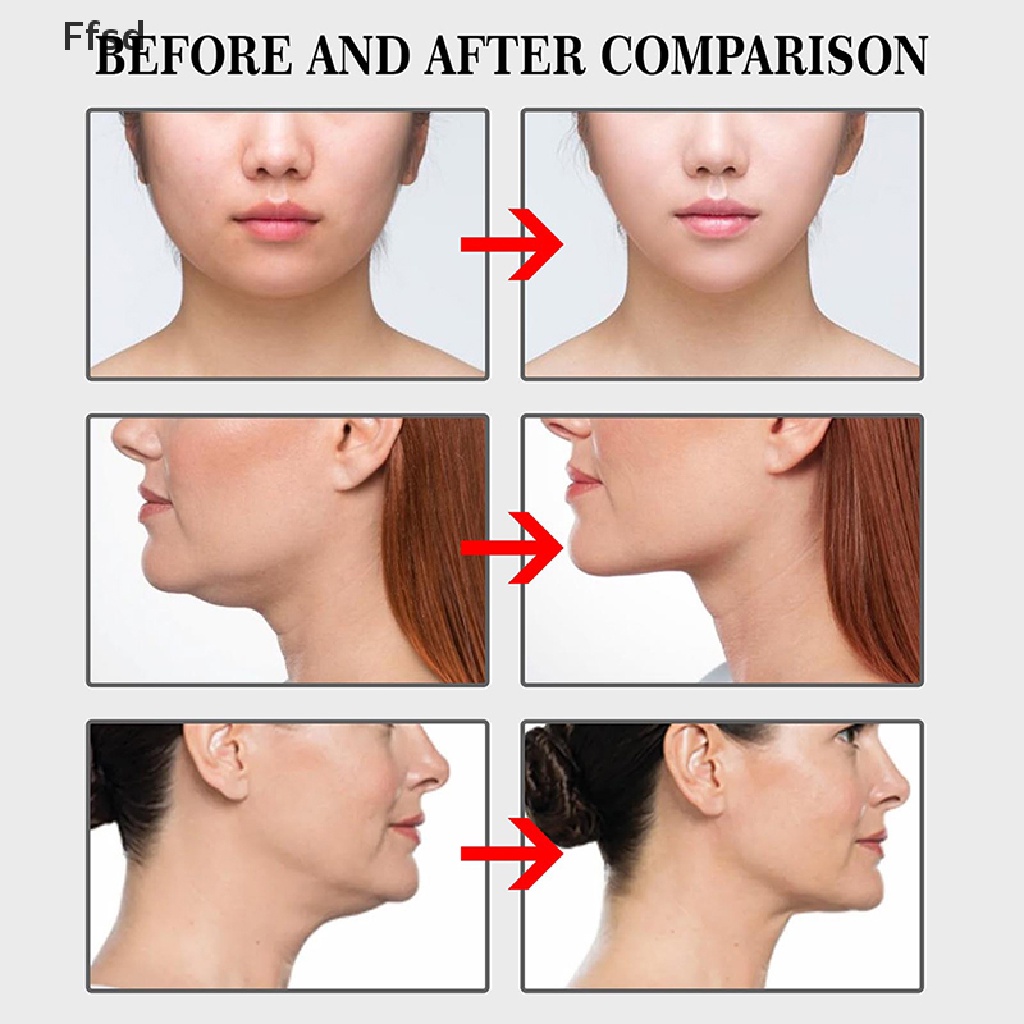 Set 100 Miếng Dán Nâng Cơ Mặt Chữ V Vô Hình