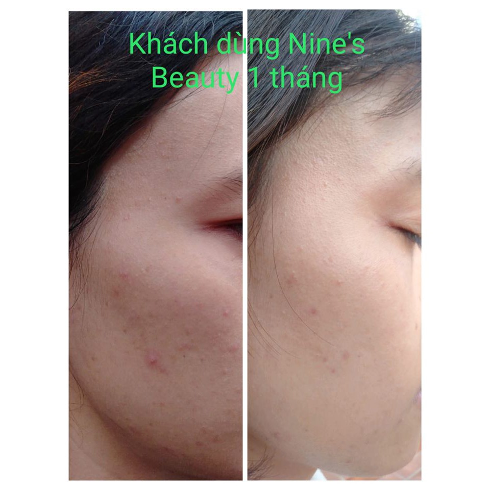 [CHÍNH HÃNG] Viên uống trắng da Nine's Beauty Chống lão hóa Giảm Nếp Nhăn giảm nám tàn nhang, Cân bằng Nội tiết Nines