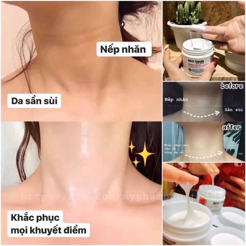 KEM DƯỠNG XOÁ NHĂN CỔ SỐ 1 HÀN QUỐC