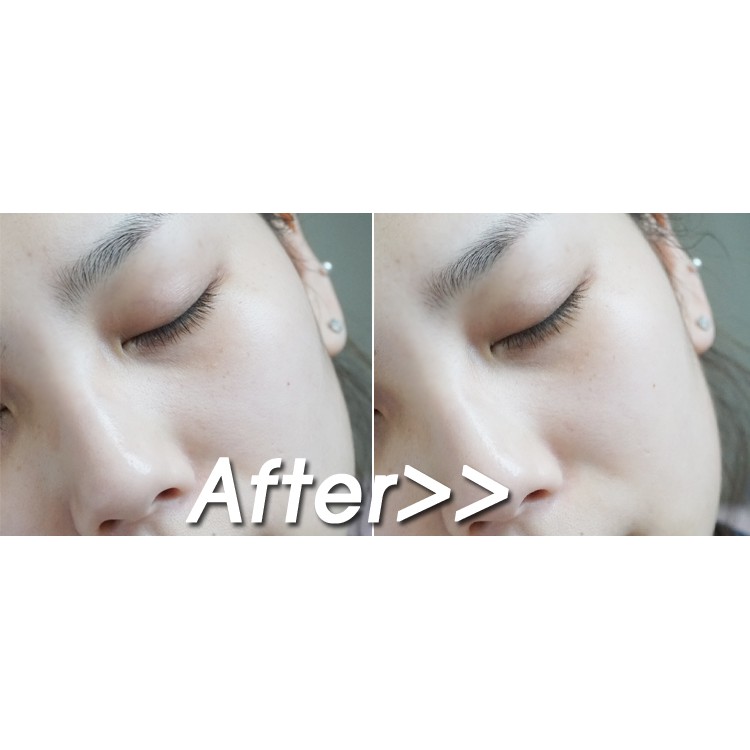 Nước Hoa Hồng Se Khít Lỗ Chân Lông SKINMISO PORE PURIFYING TONER_Mỹ phẩm Hàn Quốc chính hãng