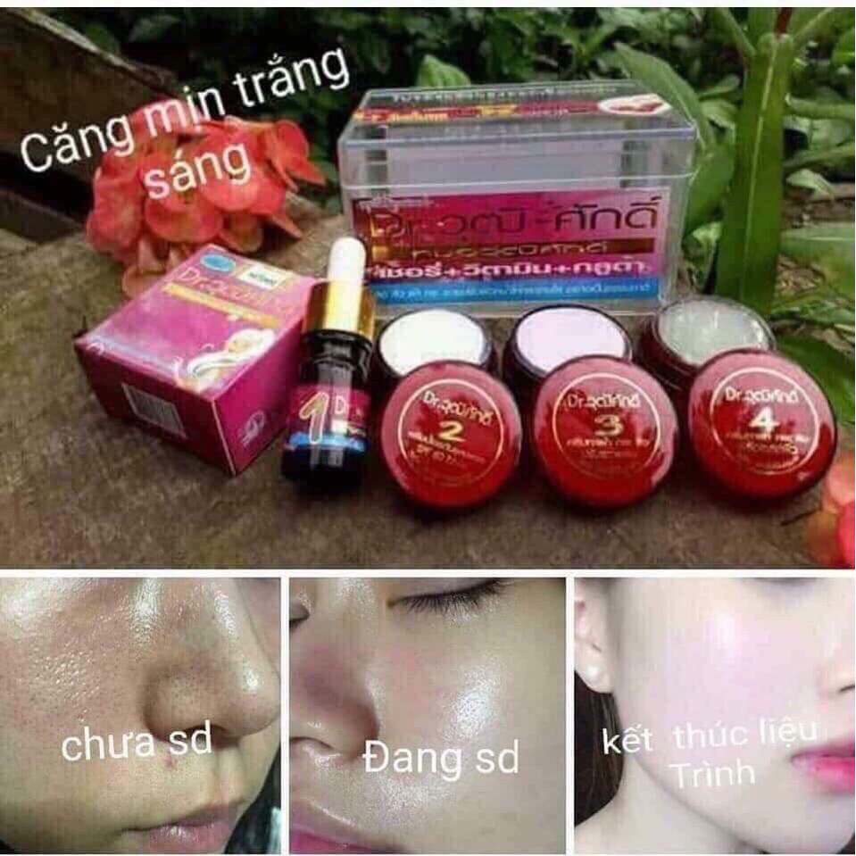 Bộ Kem Nám Sạm Da Chính Hiệu Yahee Thái Lan