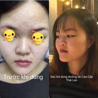 [TO] Kem dưỡng da cao cấp Thái Lan