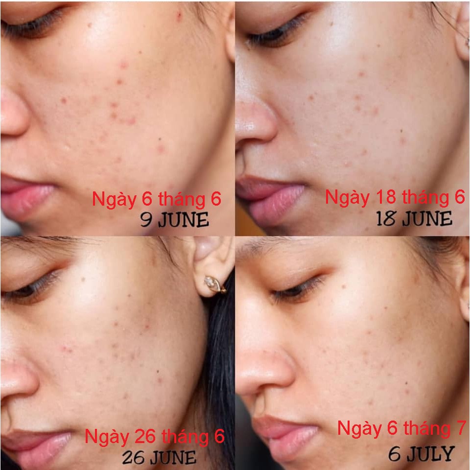 Tinh Chất Serum Vitamin C Klairs MOON21 Freshly Juiced Vitamin Drop 35ml Mờ Thâm Mụn Dưỡng Trắng Trẻ Hóa Da