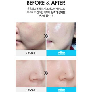 Kem dưỡng Ngọc trai Medi Peel Blue Aqua Tox Cream Medipeel FREESHIP  Kem dưỡng Ngọc trai HALIN56656