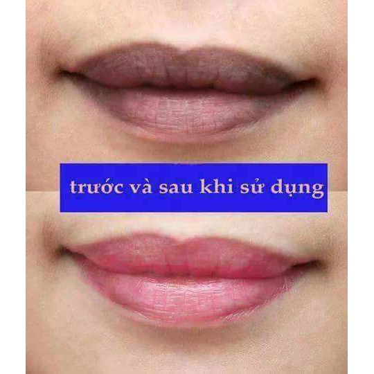 SERUM DƯỠNG MÔI, GIẢM THÂM MÔI MẪU MỚI | BigBuy360 - bigbuy360.vn