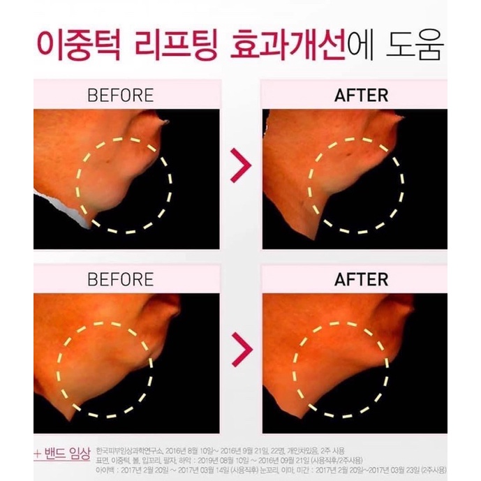 ĐAI NÂNG CƠ MẶT V- LINE THON GỌN sau 2 tháng sử dụng | NHUNG SWEET MAKE-UP