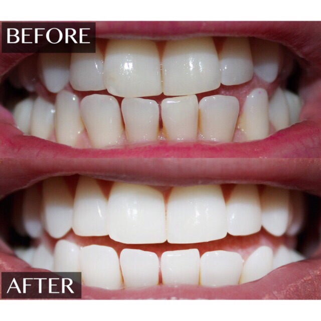 Miếng dán trắng răng Crest White thuộc dòng sản phẩm Crest 3D White