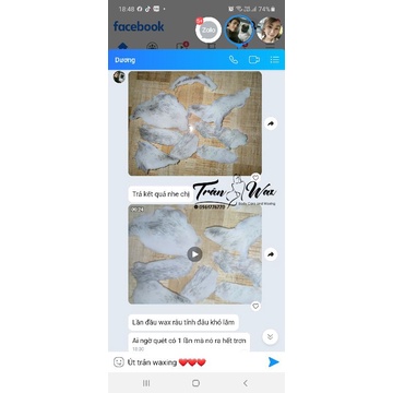 Combo waxing + Mỡ trăn | BigBuy360 - bigbuy360.vn