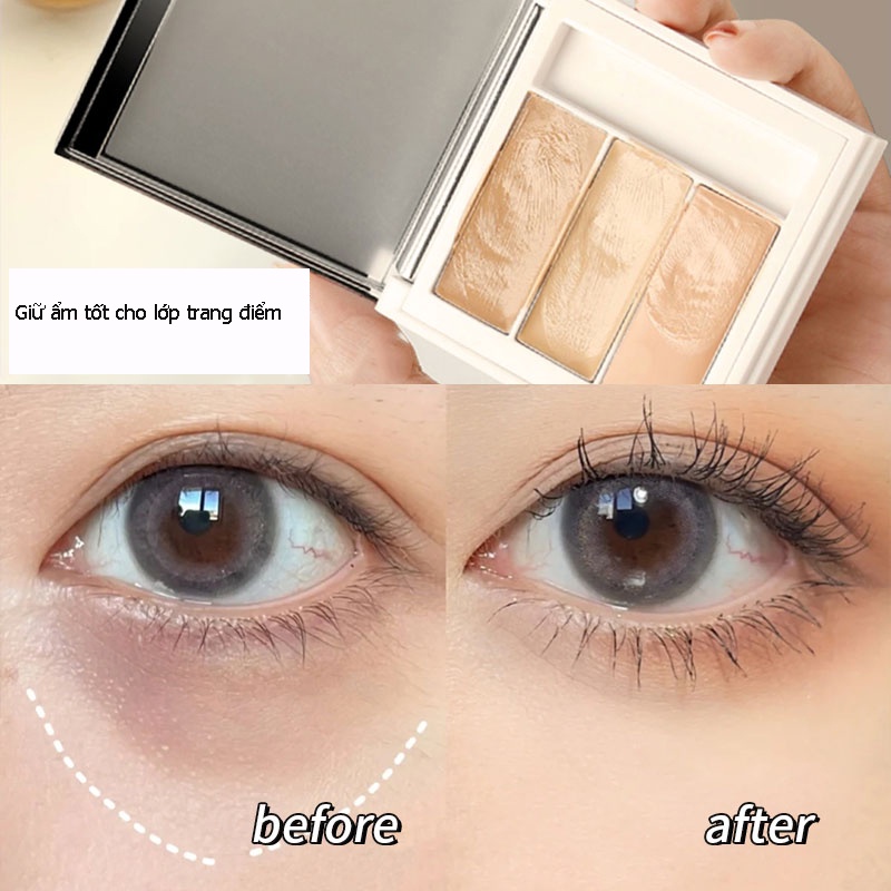 Rnw Bảng Kem Che Khuyết Điểm Ba Màu Che Phủ Mụn Và Quầng Thâm Hiệu Quả