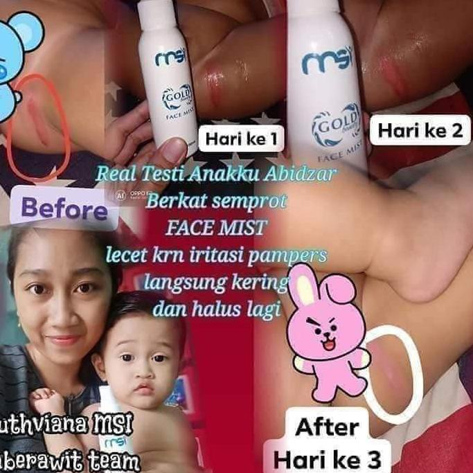 Cổ phiếu trị giá	1 chai tinh chất vàng 100% nguyên bản từ MSI | BigBuy360 - bigbuy360.vn