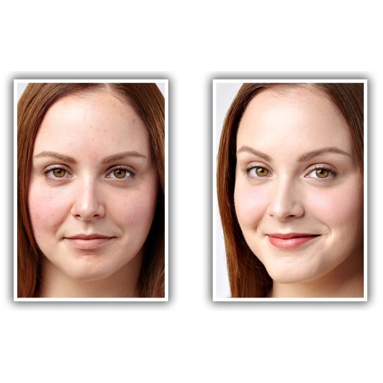 Bột Khoáng Che Khuyết Điểm BareMinerals Concealer SPF 20 (Bisque) | BigBuy360 - bigbuy360.vn