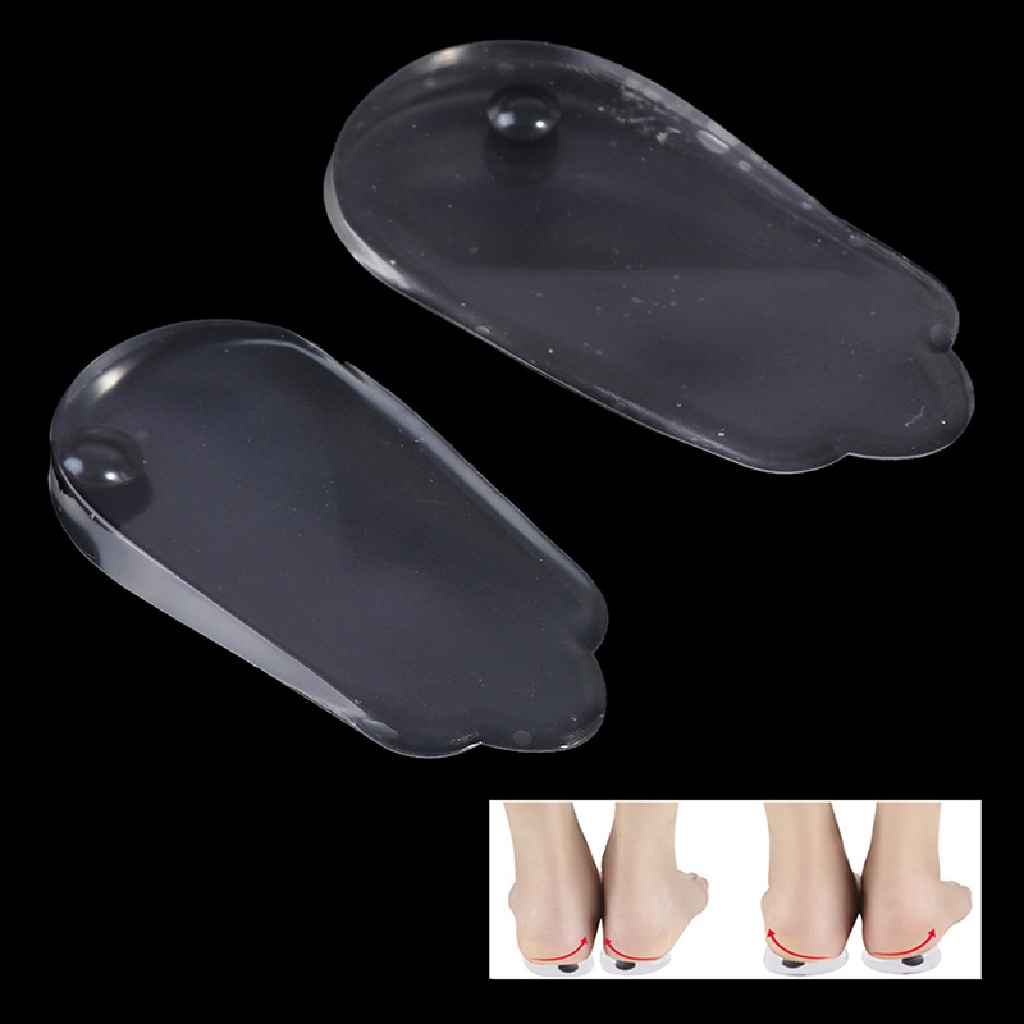 [[UVIG]] 2PCS O/X Type Legs Correction Insole Heel Varus Correction Pad Magnet heel pad [Hot Sell]