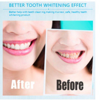 Máy tẩy trắng răng SMILEKIT cao cấp - Máy làm trắng răng tại nhà nhanh chóng, an toàn cho răng