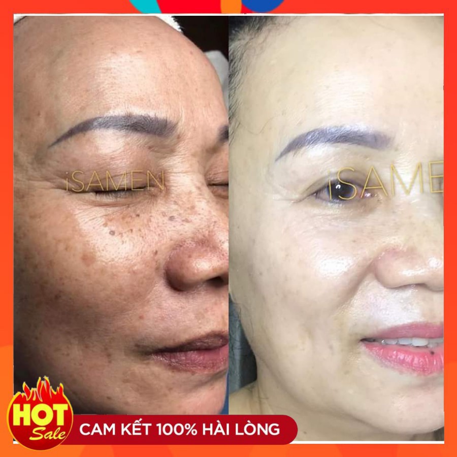 Kem phục hồi ISAMEN dưỡng da, phục hồi da da mỏng yếu, bổ sung collagen | BigBuy360 - bigbuy360.vn