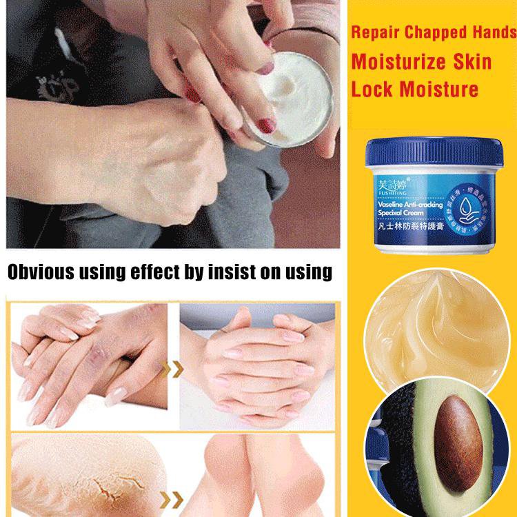 Kem Dưỡng Da Tay Vaseline Dưỡng Ẩm Chống Nứt Nẻ/Lão Hóa Cải Thiện Làn Da Khô 80g