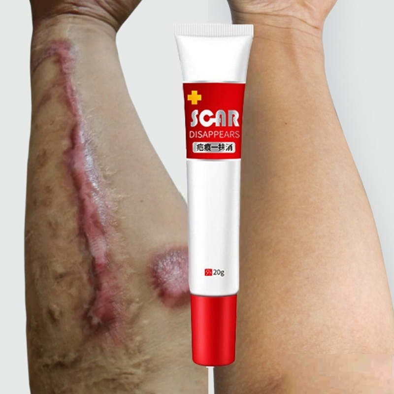 Kem Dưỡng Da Mặt Giảm Sẹo Mụn 20G