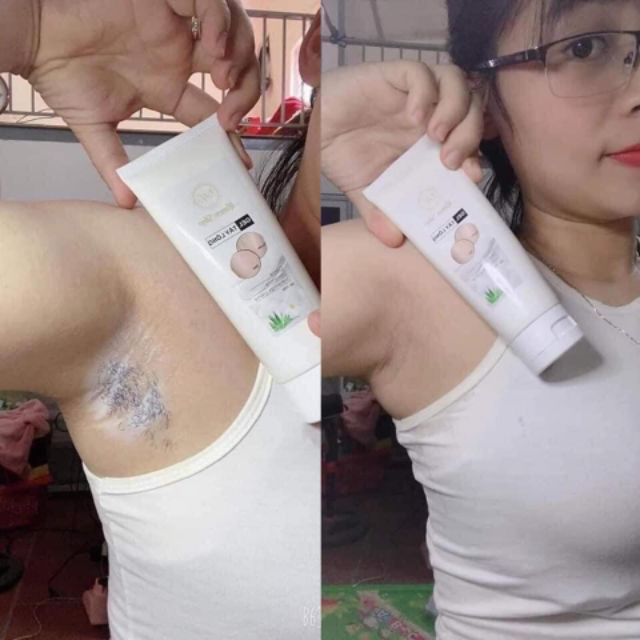 Kem triệt lông râu tận gốc vĩnh viễn thảo dược