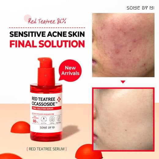 Tinh chất Tràm Trà Đỏ Some By Mi Red Tea Tree Cicassoside Derma Solution Serum 50ml ⁣