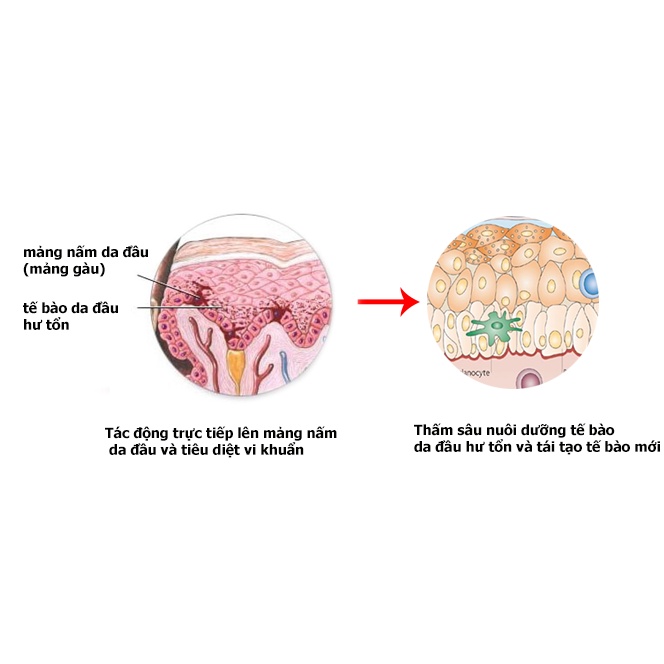 Dầu Gội Dược Liệu Loại Bỏ Gàu, Nấm Da Đầu Giúp Hết Gàu Hết Ngứa Sạch Sẽ Da Đầu Phạm Tuân PT 100ML