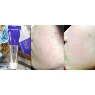 (CÓ BILL) Kem LION PAIR ACNE Nhật Bản