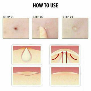 Bộ 24 Miếng Dán Mụn Hydrocolloid Chăm Sóc Da