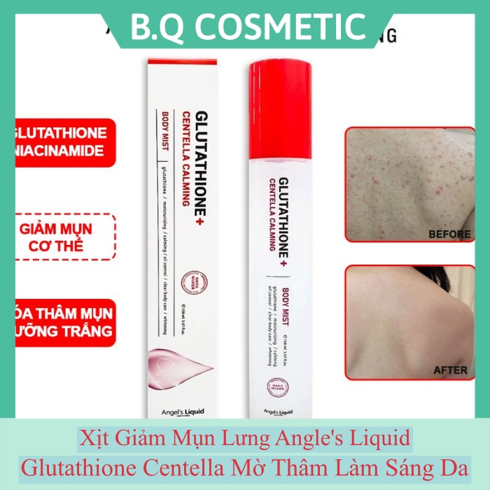 [Hot Deal] Xịt Giảm Mụn Lưng Angle's Liquid Glutathione Centella Mờ Thâm Làm Sáng Da