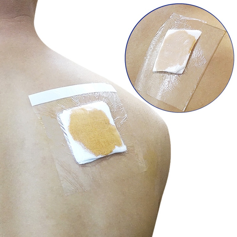 Bộ 10 Cuộn Băng Keo PU Dán Vết Thương Thoải Mái