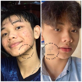 Thảo dược tái tạo da