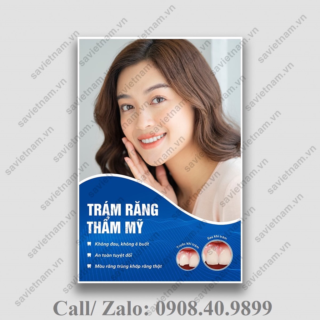 Tranh nha khoa chủ đề: Trám răng, Tẩy trắng, điều trị nha chu, điều trị tủy, CT cone beam, chỉnh nha cố định, invisalign