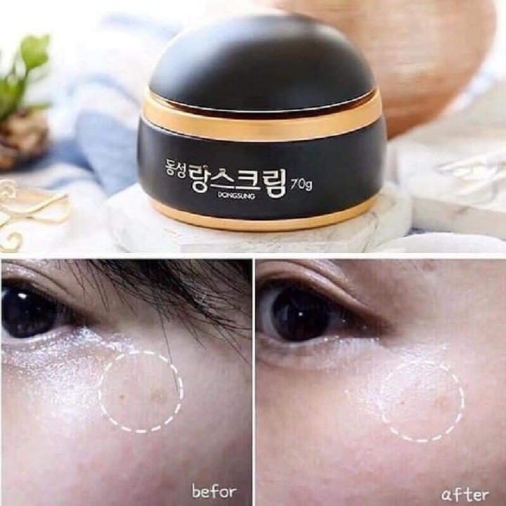 Kem dưỡng da ban đêm Dongsung Rannce 70g giảm thâm nám