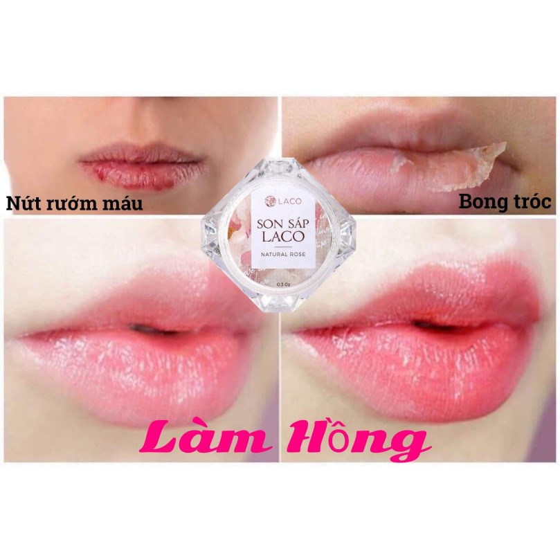 SON DƯỠNG MÔI KHÔNG MÀU CỦA LACO | BigBuy360 - bigbuy360.vn