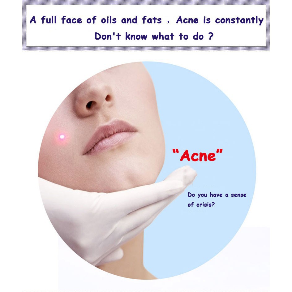 Tinh dầu Hỗ Trợ Giảm mụn dưỡng ẩm trắng da nhãn hiệu Bioaqua | BigBuy360 - bigbuy360.vn