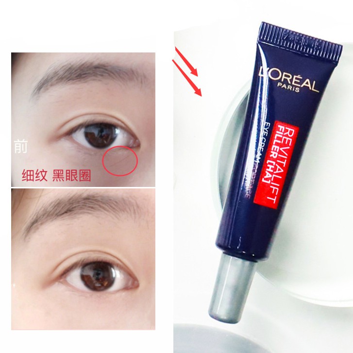 L'OREAL L 'Oreal Kem Dưỡng Ẩm Chống Nếp Nhăn Cho Mắt 30ml