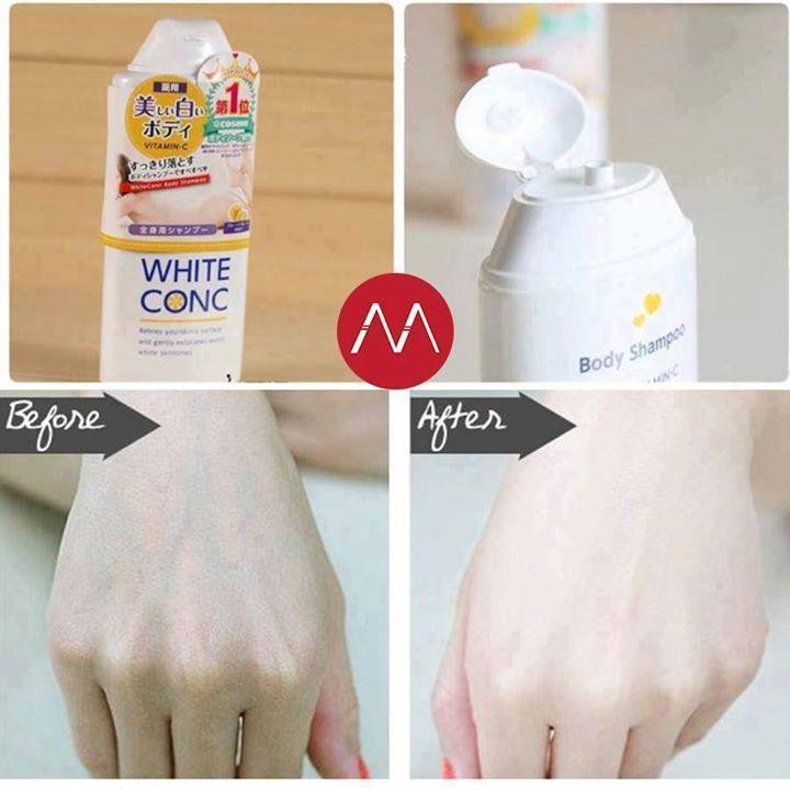 Sữa tắm trắng da WHITE CONC BODY VITAMIN C