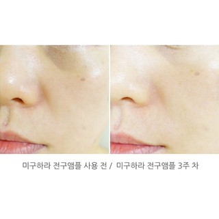 Tinh chất dưỡng trắng Miguhara