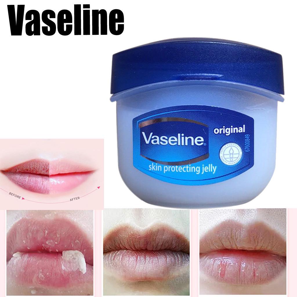 Sáp dưỡng môi Vaseline Lip Therapy 7g