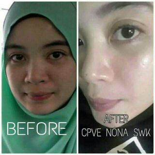 💝KEM DƯỠNG DA + SOAP RỬA MẶT💋COLLAGEN PLUS VIT E💋INDONESIA