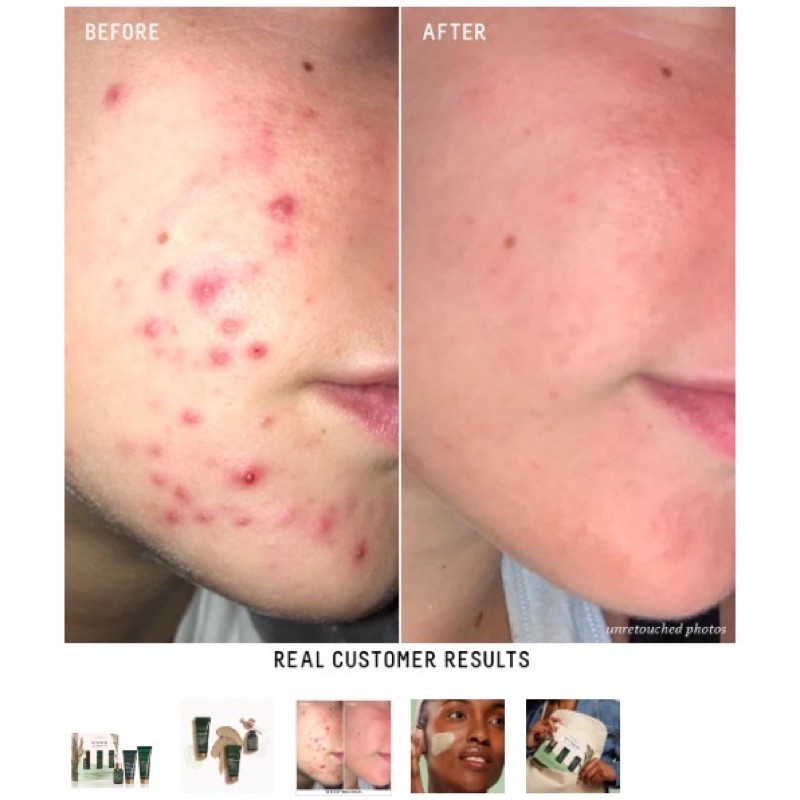 Có bill 🇺🇸 Tách lẻ serum, kem dưỡng, gel dưỡng, dầu dưỡng da BIOSSANCE Squalane retinol mini