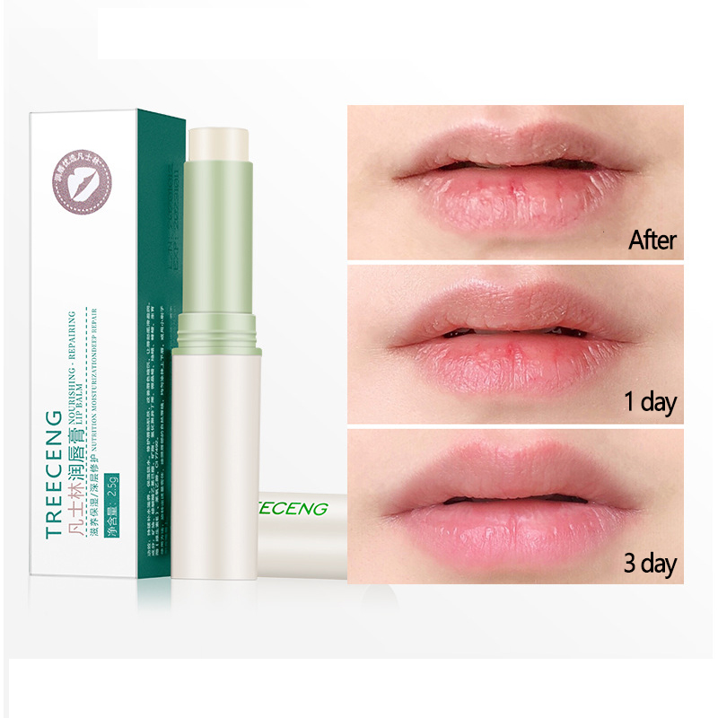 [Hàng mới về] Son dưỡng Vaseline ẩm chống khô môi cho nam và nữ | BigBuy360 - bigbuy360.vn