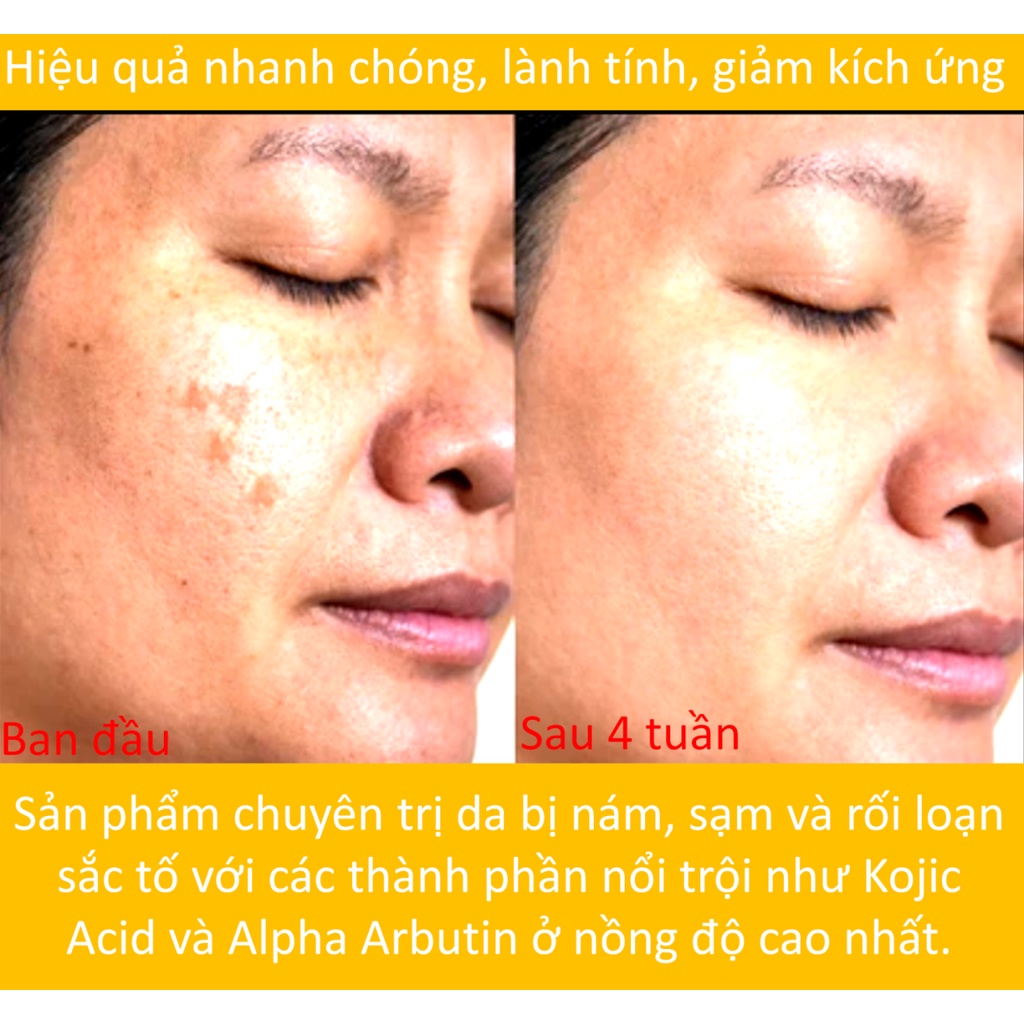 20% Niacinamide 4% Vitamin C trắng da mờ thâm dupe Paula’s Choice