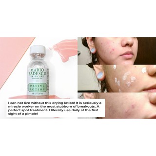 Chấm mụn Mario Badescu Drying Lotion