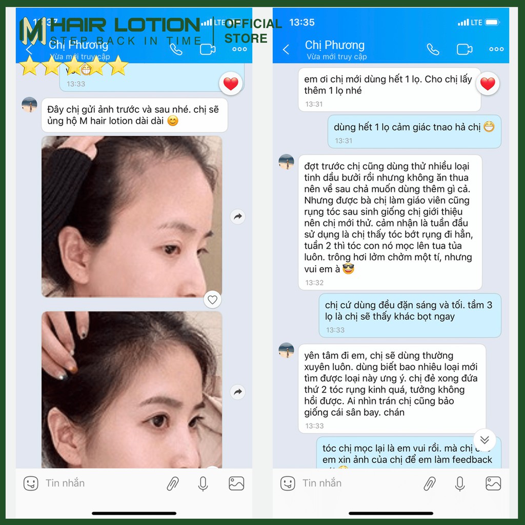 Tinh Dầu Mọc Tóc Nhanh M Hair Lotion 50ml | Ngăn Rụng Tóc | Không Dùng Với Tinh Dầu Bưởi Mọc Tóc Để Có Hiệu Quả Tốt Nhất | BigBuy360 - bigbuy360.vn