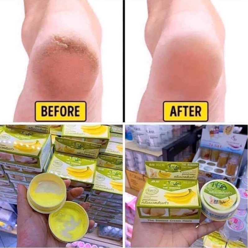 [100% Thái] Kem thoa nứt gót chân chuối Banana Cream Thái Lan
