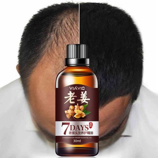 Tinh dầu gừng kích thích mọc tóc cung cấp dưỡng chất chống rụng tóc-BBYA4-168