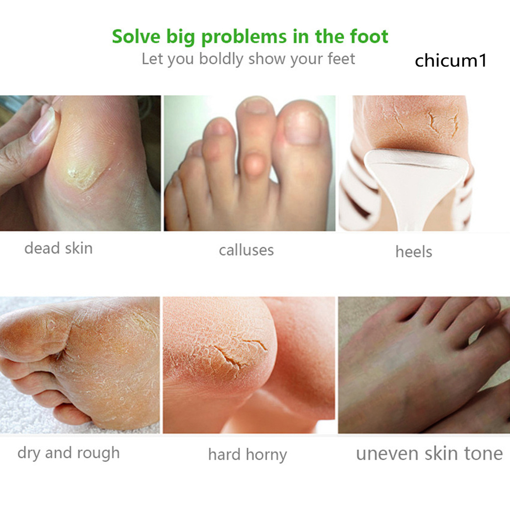 [Hàng mới về] Cặp mặt nạ chân 35g dưỡng ẩm làm mịn da